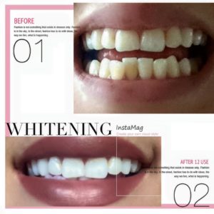 Fluoride Whitening Toothpaste